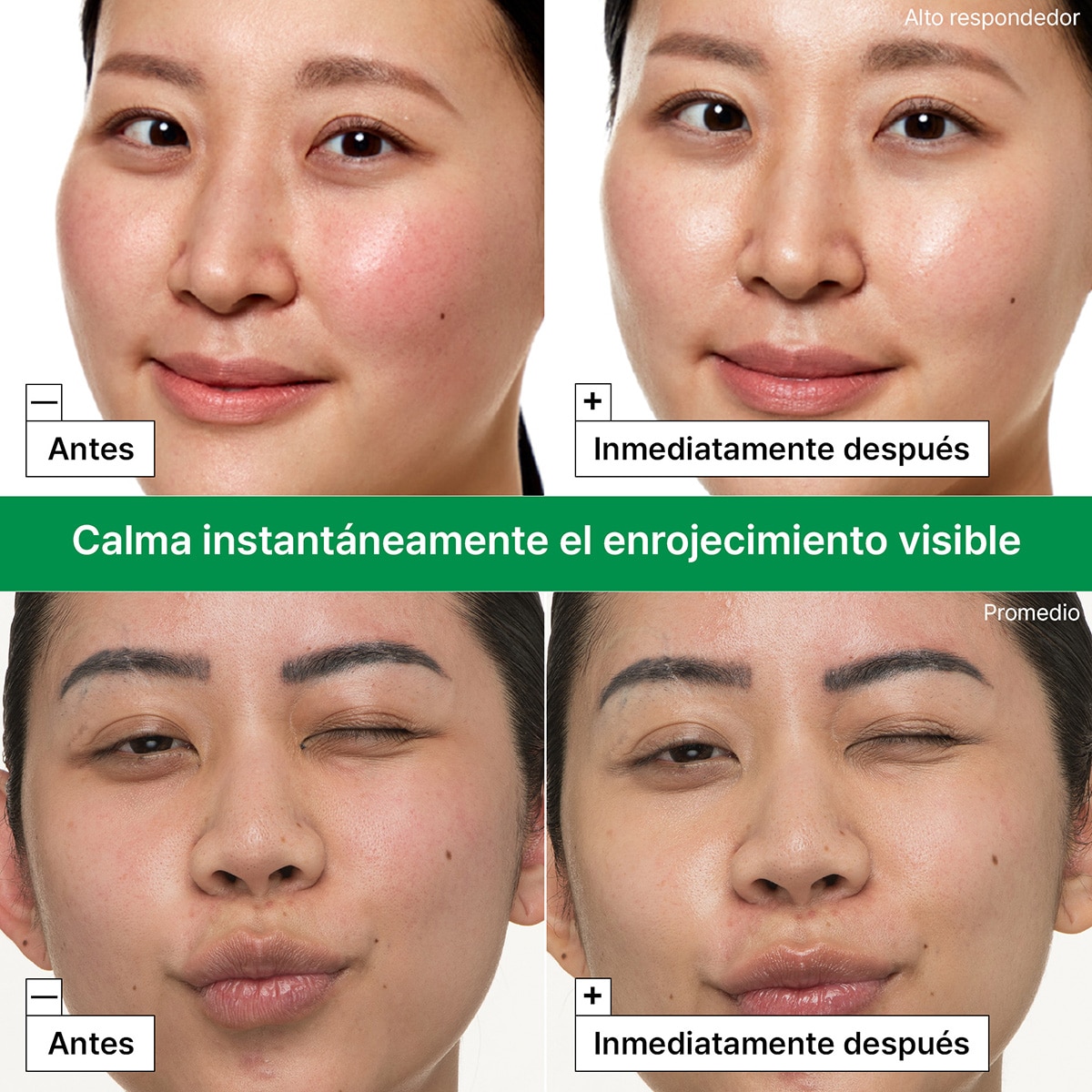 CICAPAIR™ INTENSIVE SOOTHING REPAIR CREAM (CREMA REPARADORA PARA ROSTRO)